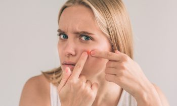 <strong>How to Prevent Acne After Eating Sugar</strong>
